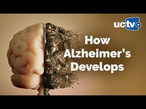 A brain model on one side disintegrates into dust on the other, with "How Alzheimer's Develops" text and UCTV logo overlaid
